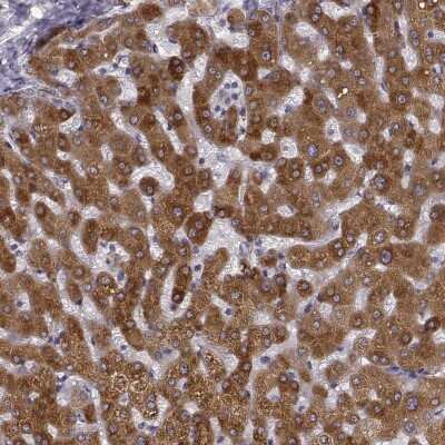 Immunohistochemistry-Paraffin: Growth Hormone R Antibody [NBP2-58925]