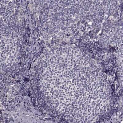 Immunohistochemistry-Paraffin: Growth Hormone R Antibody [NBP2-58925]