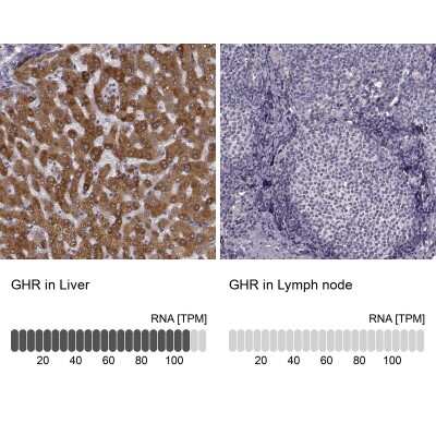 Immunohistochemistry-Paraffin: Growth Hormone R Antibody [NBP2-58925]