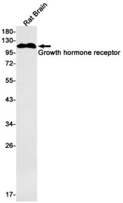 Western Blot: Growth Hormone R Antibody (S02-6E6) [NBP3-19651]