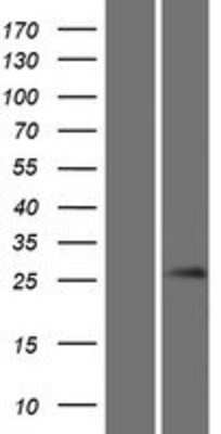 Western Blot: Gsh1 Overexpression Lysate [NBP2-05480]