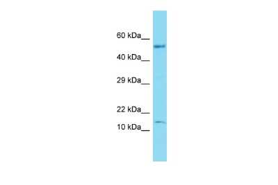 Western Blot: Gtlf3b Antibody [NBP3-09665]