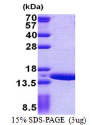 SDS-PAGE: Recombinant Human Gtlf3b His Protein [NBP2-22780]