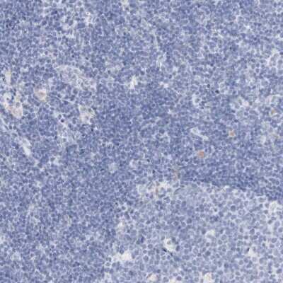 Immunohistochemistry-Paraffin: Guanine deaminase Antibody [NBP1-87454]