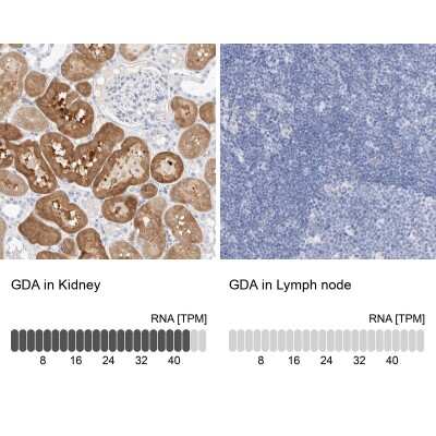 Immunohistochemistry-Paraffin: Guanine deaminase Antibody [NBP1-87454]