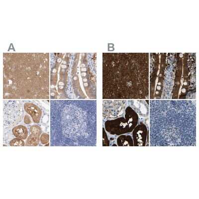 Immunohistochemistry-Paraffin: Guanine deaminase Antibody [NBP1-87454]