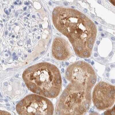 Immunohistochemistry-Paraffin: Guanine deaminase Antibody [NBP1-87454]