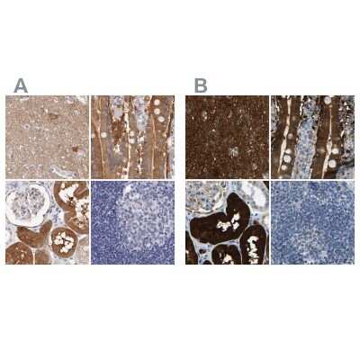 Immunohistochemistry-Paraffin: Guanine deaminase Antibody [NBP1-87525]