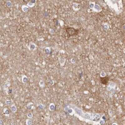 Immunohistochemistry-Paraffin: Guanine deaminase Antibody [NBP1-87525]