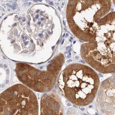 Immunohistochemistry-Paraffin: Guanine deaminase Antibody [NBP1-87525]