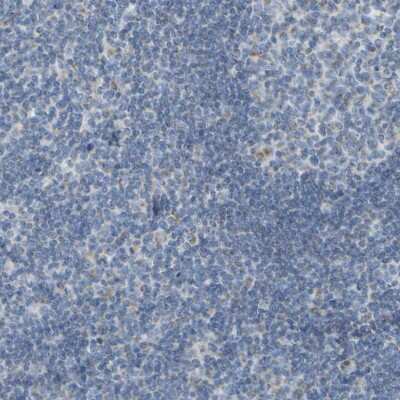 Immunohistochemistry-Paraffin: Guanine deaminase Antibody [NBP1-87562]
