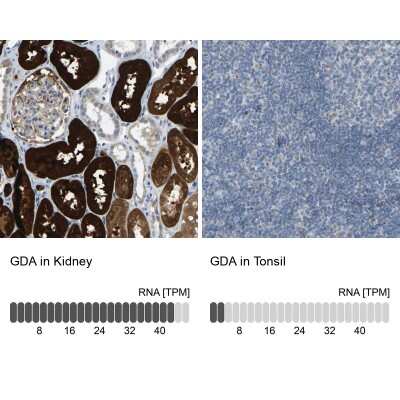 Immunohistochemistry-Paraffin: Guanine deaminase Antibody [NBP1-87562]