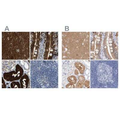 Immunohistochemistry-Paraffin: Guanine deaminase Antibody [NBP1-87562]