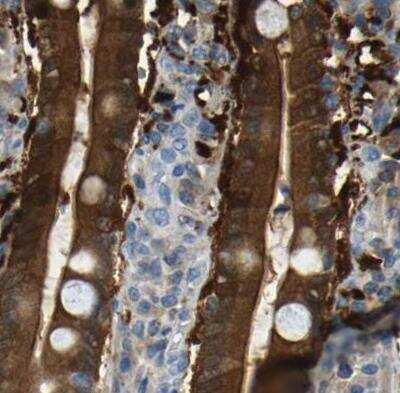 Immunohistochemistry-Paraffin: Guanine deaminase Antibody [NBP1-87562]