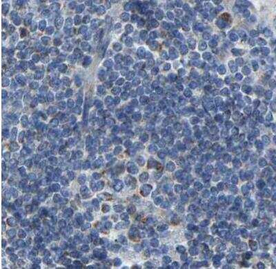 Immunohistochemistry-Paraffin: Guanine deaminase Antibody [NBP1-87562]