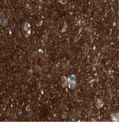 Immunohistochemistry-Paraffin: Guanine deaminase Antibody [NBP1-87562]