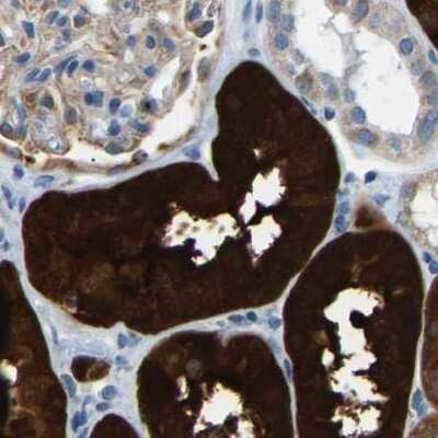 Immunohistochemistry-Paraffin: Guanine deaminase Antibody [NBP1-87562]