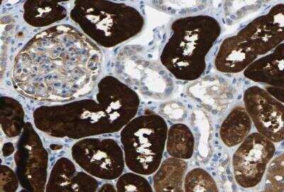 Immunohistochemistry-Paraffin: Guanine deaminase Antibody [NBP1-87562]