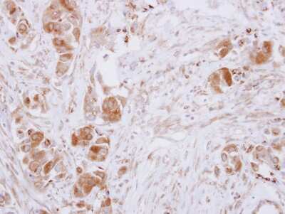 Immunohistochemistry-Paraffin: Guanine deaminase Antibody [NBP2-16769]