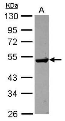 Western Blot: Guanine deaminase Antibody [NBP2-16769]