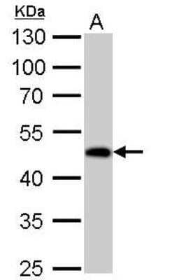 Western Blot: Guanine deaminase Antibody [NBP2-16769]