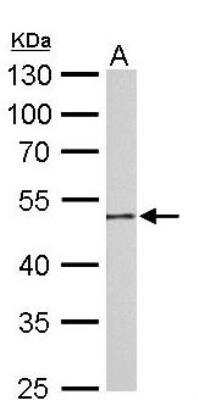 Western Blot: Guanine deaminase Antibody [NBP2-16769]