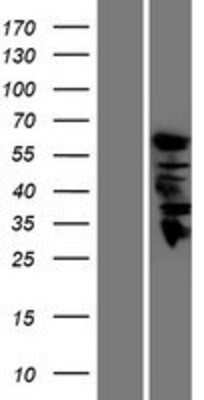 Western Blot: Guanine deaminase Overexpression Lysate [NBP2-10586]