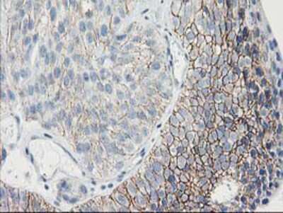 Immunohistochemistry-Paraffin: Guanylate kinase Antibody (OTI4A8) [NBP2-00594]