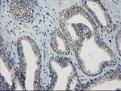 Immunohistochemistry-Paraffin: Guanylate kinase Antibody (OTI4A8) [NBP2-00594]