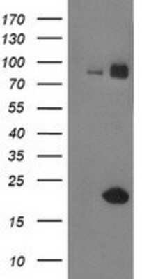 Western Blot: Guanylate kinase Antibody (OTI4A8) [NBP2-00594]