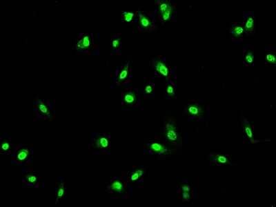 Immunocytochemistry/ Immunofluorescence: Guanylate kinase Antibody [NBP2-97222]