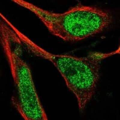 Immunocytochemistry/ Immunofluorescence: Guanylate kinase Antibody [NBP3-17671]