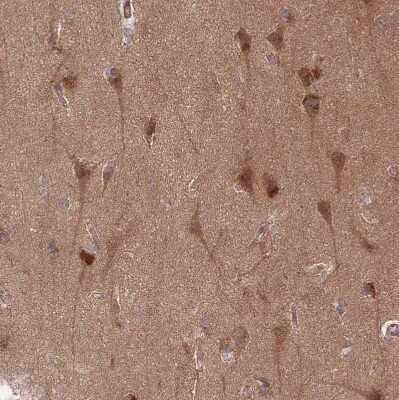 Immunohistochemistry-Paraffin: Guanylate kinase Antibody [NBP2-14078]