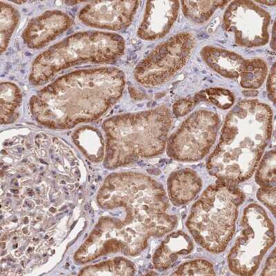 Immunohistochemistry-Paraffin: Guanylate kinase Antibody [NBP2-14078]