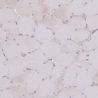 Immunohistochemistry-Paraffin: Guanylate kinase Antibody [NBP2-14078]