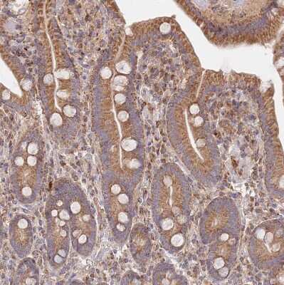 Immunohistochemistry-Paraffin: Guanylate kinase Antibody [NBP2-14078]