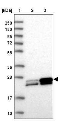 Western Blot: Guanylate kinase Antibody [NBP2-14078]