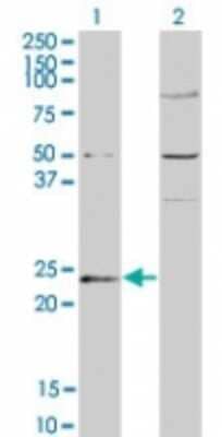 Western Blot: Guanylate kinase Antibody [NBP2-23758]