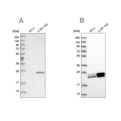 Western Blot: Guanylate kinase Antibody [NBP2-76521]