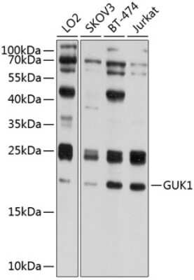 Western Blot: Guanylate kinase AntibodyBSA Free [NBP3-03325]