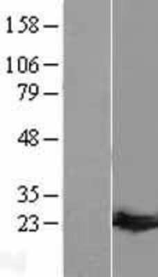 Western Blot: Guanylate kinase Overexpression Lysate [NBL1-11411]