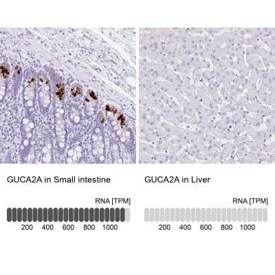 Immunohistochemistry-Paraffin: Guanylin Antibody [NBP1-89724]