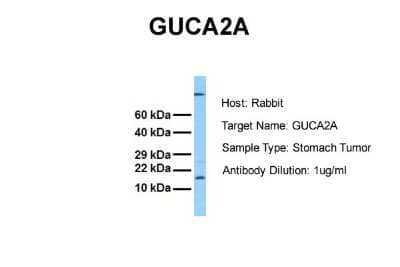 Western Blot: Guanylin Antibody [NBP2-82959]