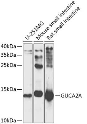 Western Blot: Guanylin AntibodyBSA Free [NBP3-03580]