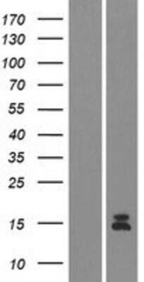 Western Blot: Guanylin Overexpression Lysate [NBP2-05849]