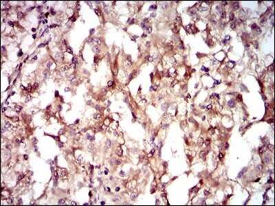 Immunohistochemistry: Guanylyl Cyclase alpha 1 Antibody (3G6B2) - BSA Free [NBP2-37401]