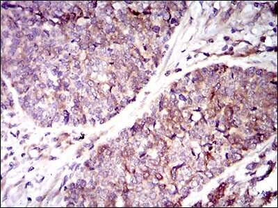 Immunohistochemistry: Guanylyl Cyclase alpha 1 Antibody (3G6B2) - BSA Free [NBP2-37401]