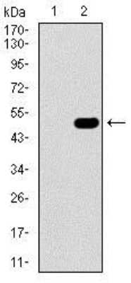 Western Blot: Guanylyl Cyclase alpha 1 Antibody (3G6B2)BSA Free [NBP2-37401]