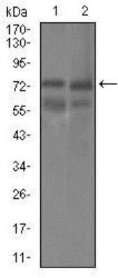 Western Blot: Guanylyl Cyclase alpha 1 Antibody (3G6B2)BSA Free [NBP2-37401]