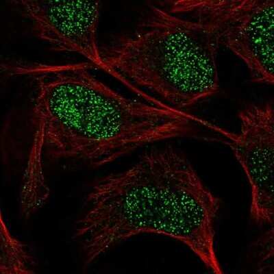 Immunocytochemistry/ Immunofluorescence: Guanylyl Cyclase alpha 1 Antibody [NBP2-68742]